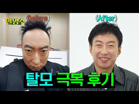 (ENG) 탈모는 늦었다고 생각할 때가 진짜 너무 늦었다 탈모 간증인의 Q&A👨‍🦲🤷‍♂️ | 할명수 ep.249