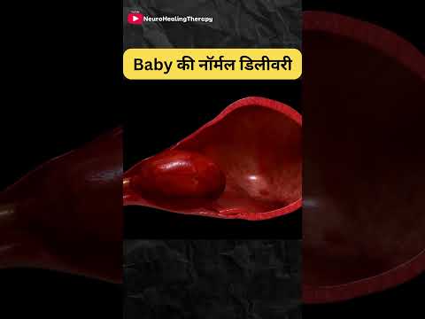 Childbirth Baby Delivery #shorts