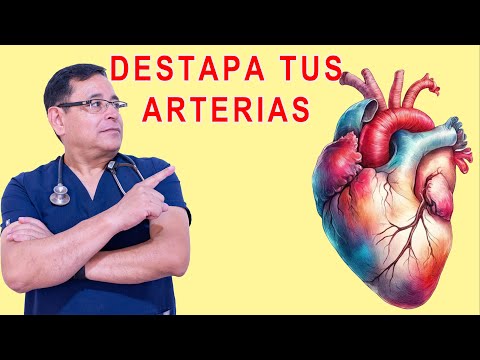 COMO DESTAPAR TUS ARTERIAS