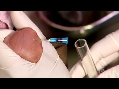 Newborn Care: Taking a Venous Blood Sample