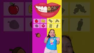Dentes Saudáveis e Não Saudáveis🦷 Alimentos Bons e Ruins para os Dentes   MC Divertida #shorts