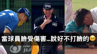 不是普通的痛…當中職球員在場上被「打臉」