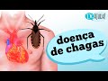 Doença de Chagas: Prevenção e Sintomas