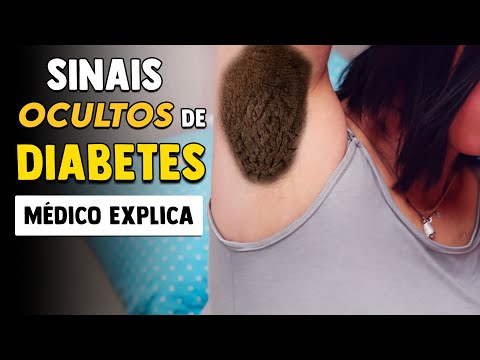 Isso pode ser DIABETES e VOCÊ NÃO SABIA! │ Sinais e Sintomas de Diabetes Mellitus