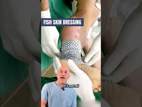 Fish Skin Band-Aid For Faster Burn Wound Healing 🔥 #shorts