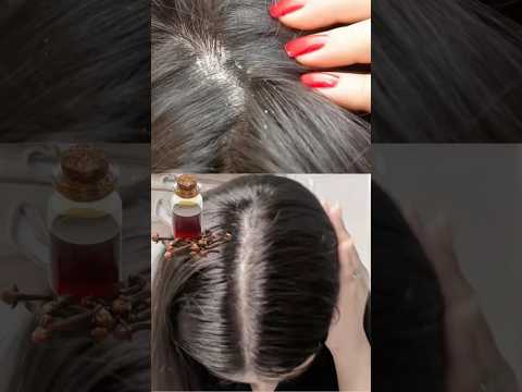 Elimina la caspa y la caída del CABELLO con este TÓNICO #tips #salud #cabello #shorts #recetas