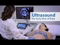 Ultrasound in Pregnancy Overview