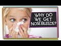 Understanding Nosebleeds