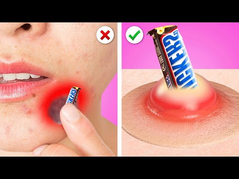 11 Ways To SNEAK FOOD INTO HOSPITAL || Funny Food Sneaking Ideas & Ways to Sneak Candies by Kaboom!