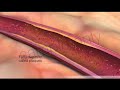 Exploring Factors Influencing Blood Flow