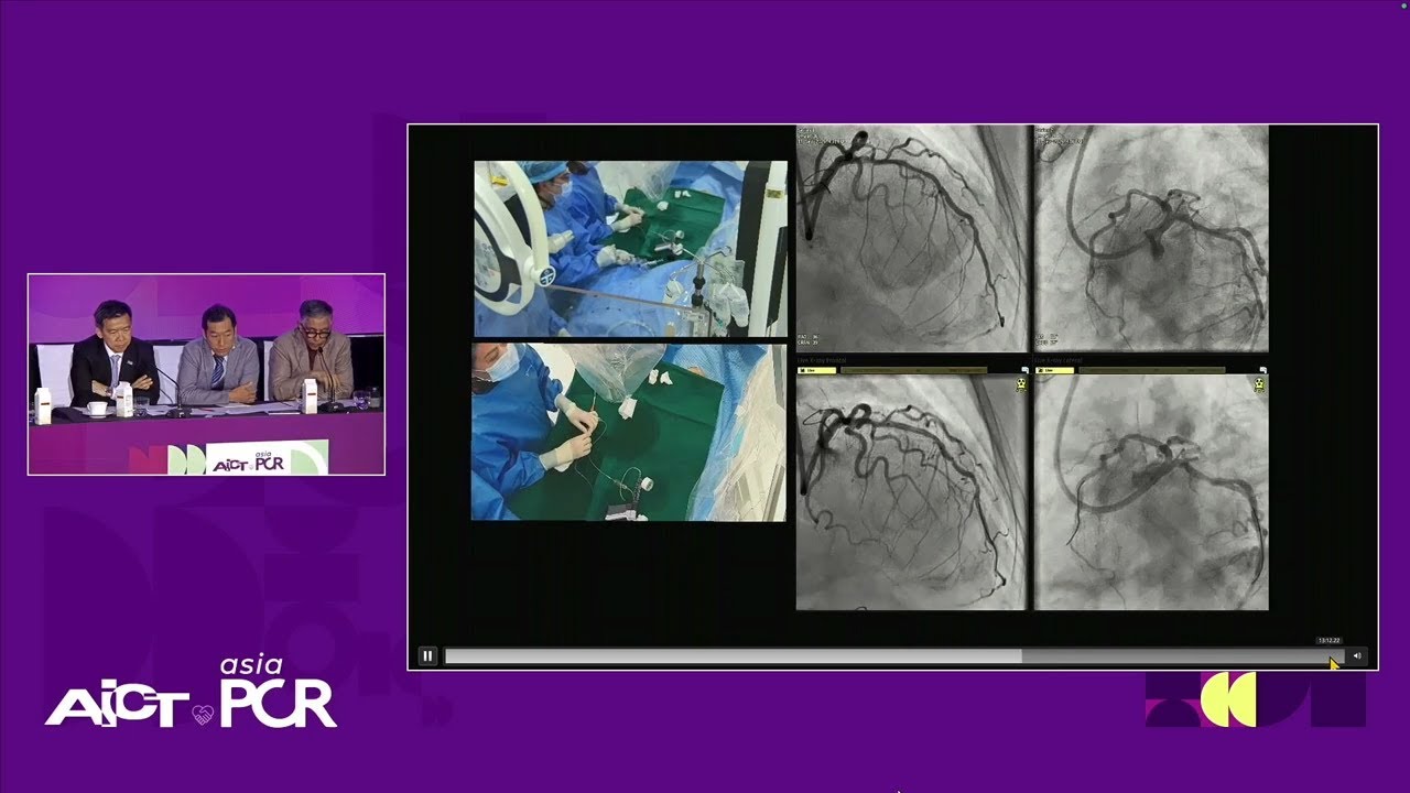Precision in plaque management: