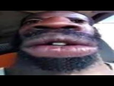 MEMES THAT WILL CURE YOUR BRAINROT