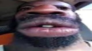 MEMES THAT WILL CURE YOUR BRAINROT