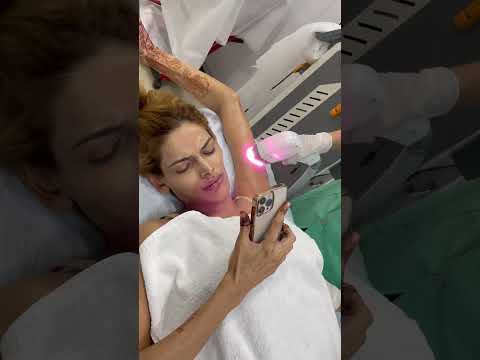 Hair removal laser at TRANSFORM CLINIC AT MULUND 086551 17797 #shorts #khushi #youtube #trending