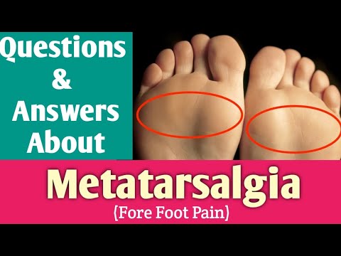 Questions & answers about metatarsalgia | Forefoot pain | per ke panje ka dard