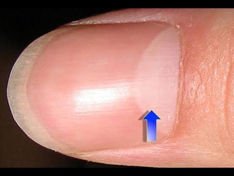 अंगूठे पर नाखून पर आधा चांद का राज क्या है? | ये संकेत है की आप एक बुद्धिमान इंसान हो | Signs
