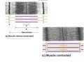 Muscle Contraction Mechanisms and Anatomy