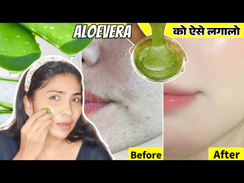 Aloevera से करे चेहरे पर जमी मैल साफ़-Bumps, Tanning, Open Pores, Pigmentation-1 बार में दिखेगा फ़र्क़💯