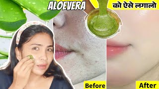 Aloevera से करे चेहरे पर जमी मैल साफ़-Bumps, Tanning, Open Pores, Pigmentation-1 बार में दिखेगा फ़र्क़💯