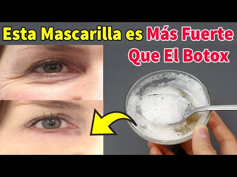 Eliminar Las Arrugas Y Ojeras Debajo De Los Ojos Con Esta Poderosa Mascarilla - Solo 3 Ingredientes