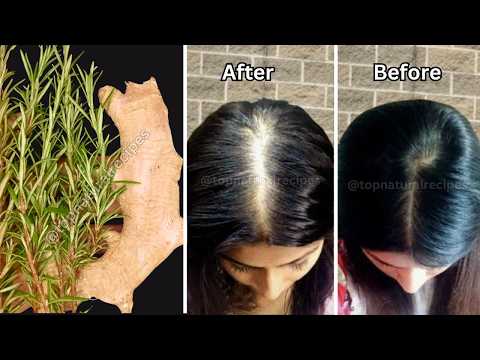 Rosemary Ginger Water For Hair Growth / Rosemary Water Benefits For Stronger, Healthier Hair