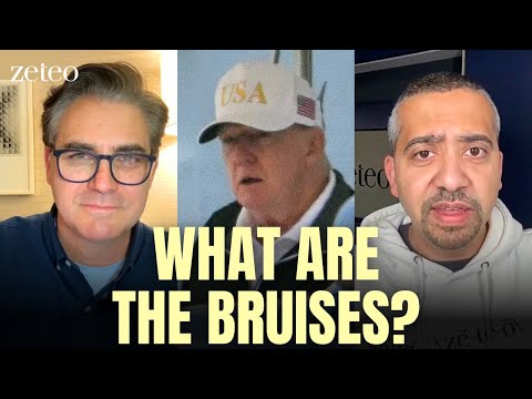'The Trump Health Cover-Up': How the Media Is COMPLICIT in a Huge Scandal