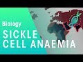 Exploring Sickle Cell Anaemia and Its Genetic Implications