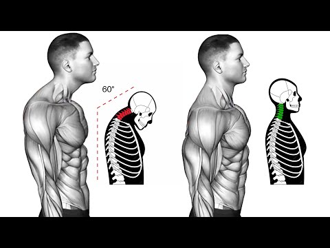 Improve My Posture in 14 Days (Get Perfect Posture)