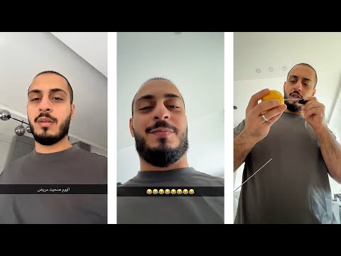 وليد صحي مريض اليوم | شو صاير معاه؟ 😥
