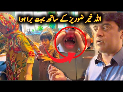 Zoraiz K Sath Bahut Bura Howa permanent Teeth Toot Gye Allah Khair 😪