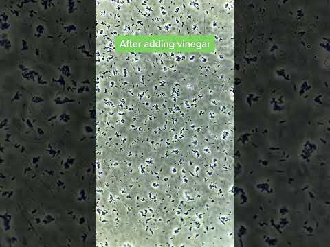 Vinegar VS Bacteria under the microscope!