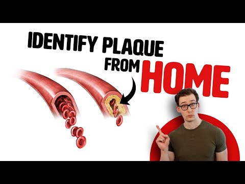 An Easy, At Home Test to Find Plaque in your Arteries