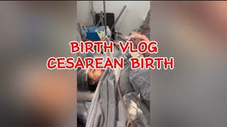 How I birth my twins via caesarean birth || Birth Vlog #viral #vlog