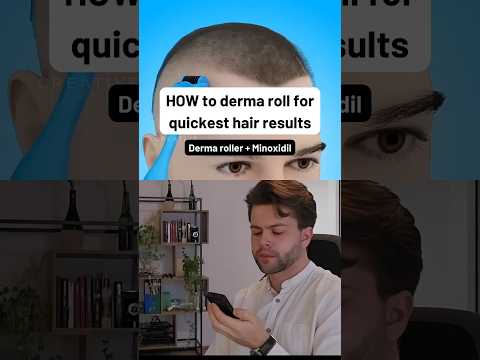 How to Dermaroll with Minoxidil for Quickest Results (Linked in Bio)