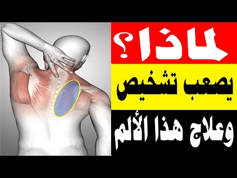 العلاج الفعال للعقد العضلية ونقاط الزناد واللفافة العضلية/أ د محمد حمادة أستاذ علاج الألم بطب الازهر