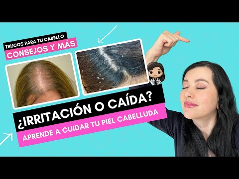 COMO CUIDAR TU PIEL CABELLUDA PARA TENER UN PELO SANO Y LINDO