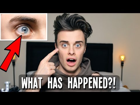 WHAT IS WRONG WITH MY EYE?!