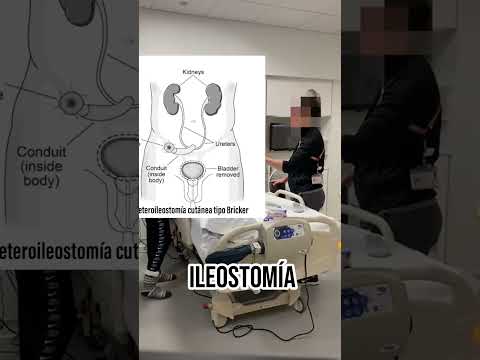 ESTE JOVEN PERDIO LA MITAD DE SU CUERPO Y SOBREVIVIÓ PREGUNTAS Y RESPUESTAS