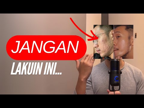 5 hal yang jangan dilakukan saat jerawatan