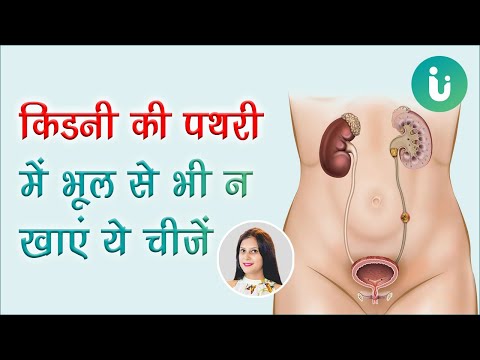 किडनी स्टोन में भूल से भी नहीं खाएं ये चीजें - जानें किडनी की पथरी में क्या खाएं, क्या नहीं खाएं