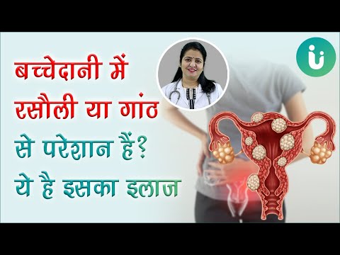 बच्चेदानी में गांठ या रसौली होने का कारण, लक्षण, इलाज, उपचार, दवा - Fibroid ka ilaj in hindi