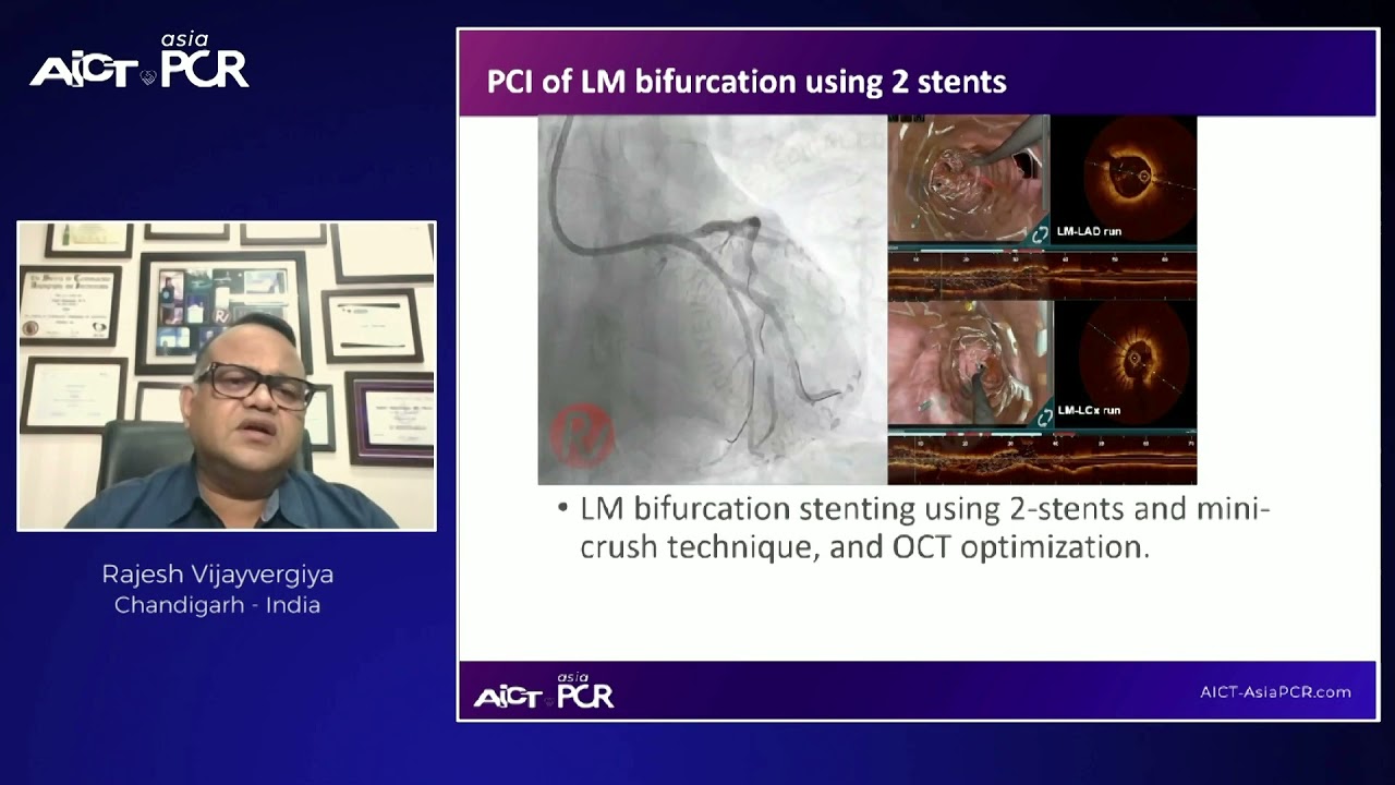 Optimised PCI in real-world