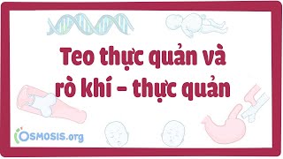 Teo thực quản và rò khí – thực quản