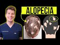 Alopecia Areata Diagnosis and Treatment