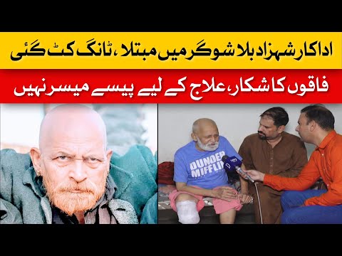 Shahzad Bila’s Tragic Condition: Leg Amputated, Struggling Without Medical Aid | Dawn News