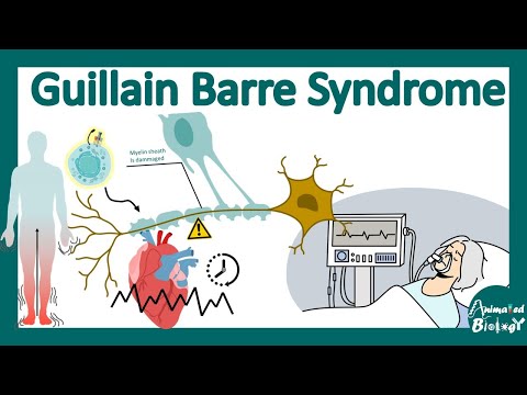 Guillain-Barré Syndrome (GBS) | Guillain-Barré Syndrome Explained: Causes, Symptoms & Treatment