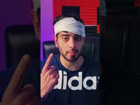 How I Broke My Head