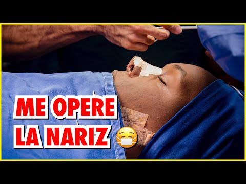 ME OPERÉ LA NARIZ Y CAMBIÓ MI VIDA PARA SIEMPRE!!😷 - Abrahamdpe