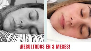 ELIMINA LAS ARRUGAS DEL SUEÑO - Almohada OMNIA COPPER