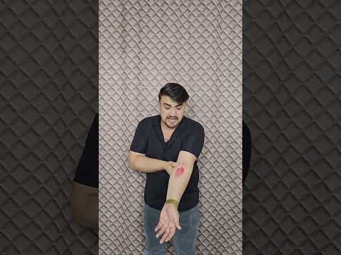 كلب يعض صاحبة | دكتور تطعيم 💉